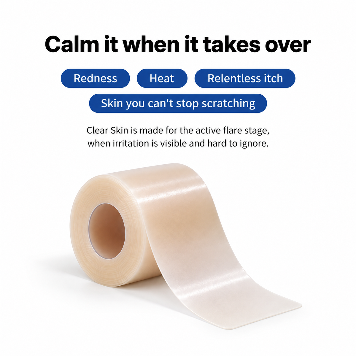 Eczema Flare Patch (16 feet roll)