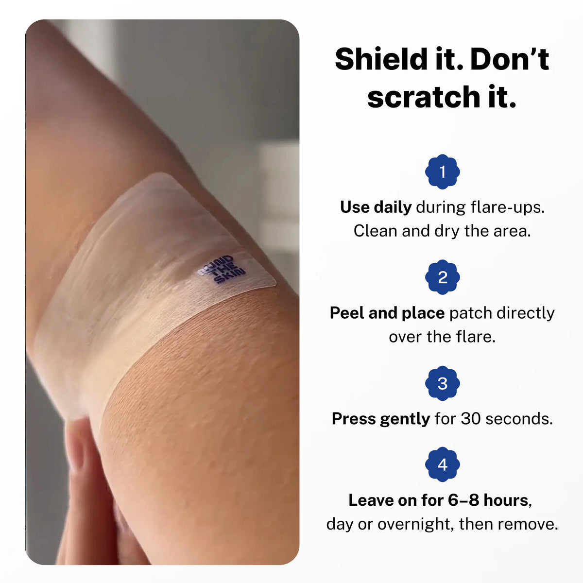 Eczema Flare Patch (16 feet roll)